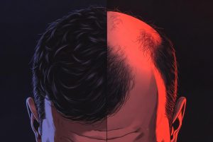 diffuse thinning top down view